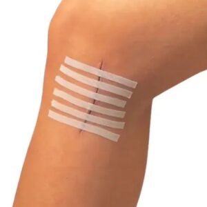 Sutura Cutanea Steri Strip R1542 3M x unidad